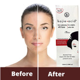 Kojie Acid Skin Brightening X10 Toner - 100ml